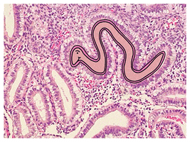 Worm Biology GIF
