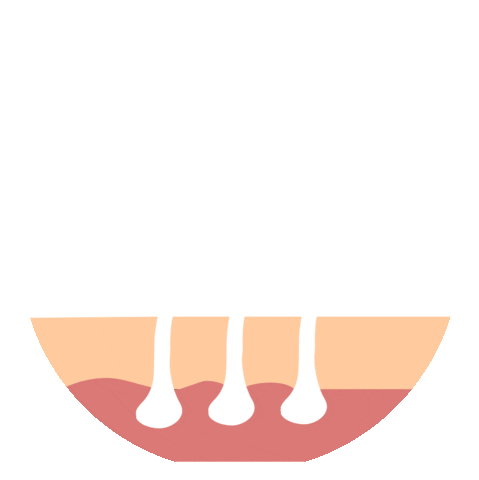 Laser Sticker by Trico Spa