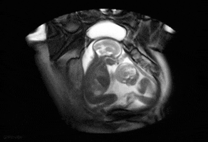 x-ray loop GIF