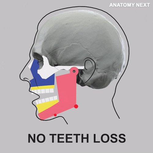 virynaye27 cancun dentistry dental implants cosmetic dentistry GIF