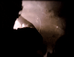 nuclear medicine gif machine nuclear medicine gif machine