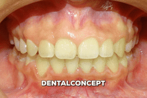 davidantoniovilcaobregon dentalconcept GIF