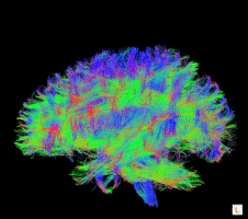 Brain Neuroscience GIF