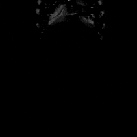 x ray skeleton GIF