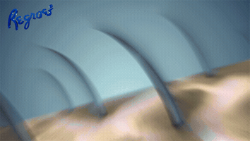 regroeminoxidil  GIF