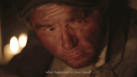 What-happened-to-your-hand GIFs - Get the best GIF on GIPHY