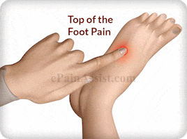 top of the foot pain GIF by ePainAssist