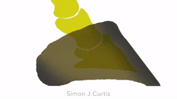 Hoof-Care Laminitis GIF