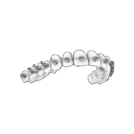 Diamond Braces Sticker