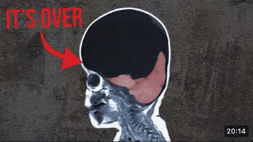 Its Over Thumbnail GIF