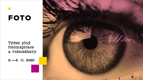 Glaucoma: The Sneaky Eye Villain That’s Robbing Nigerians Blind (And What You Can Do About It)