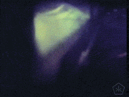 200.gif?cid=fc005b08f52f5fe77a3cd1082ed8d356dc63e7ab52888600&rid=200.gif&ct=g