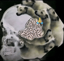 Brain GIF