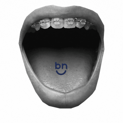 Braces Now GIF
