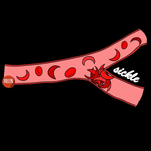 sickcells sickle cell sickle cell disease sickcells sick cells GIF