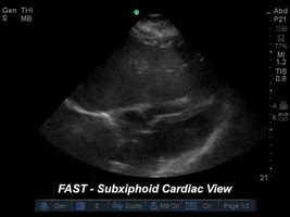 drjeffy foamed foamus GIF