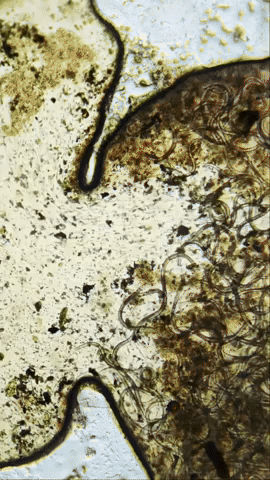 V5 Parasite Cleanse vs Parasites