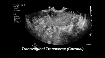drjeffy foamed foamus GIF