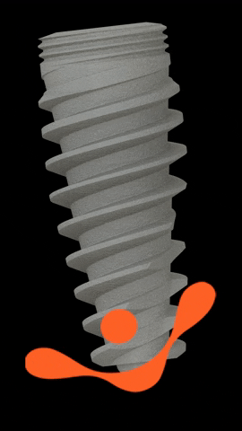 singularimplants GIF