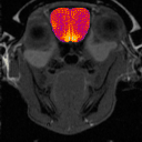 mri