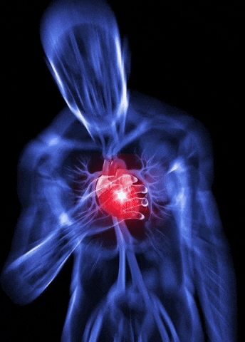 Heart Attack Xray GIF
