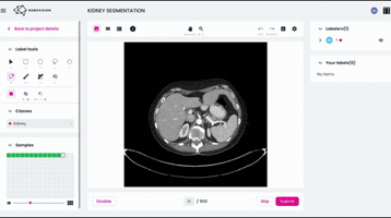 Annotation GIF