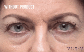 Before And After Eyes GIF by Westmore Beauty