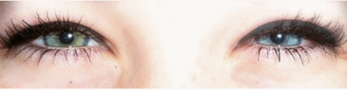 blue eyes