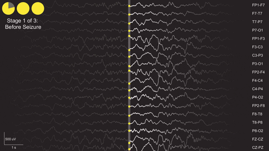 Image result for EEG gif
