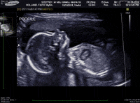Baby-in-the-womb GIFs - Get the best GIF on GIPHY