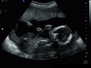 womb GIF