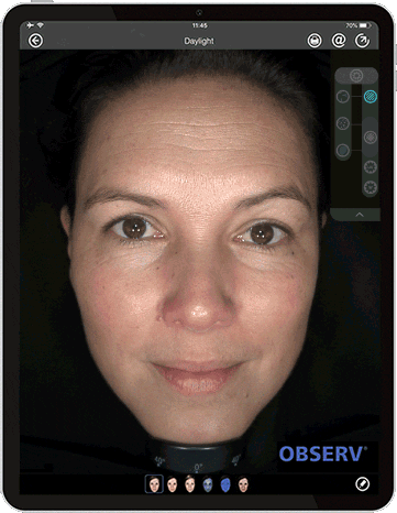 Observ GIF by Equipamentos médicos para estética corporal e facial