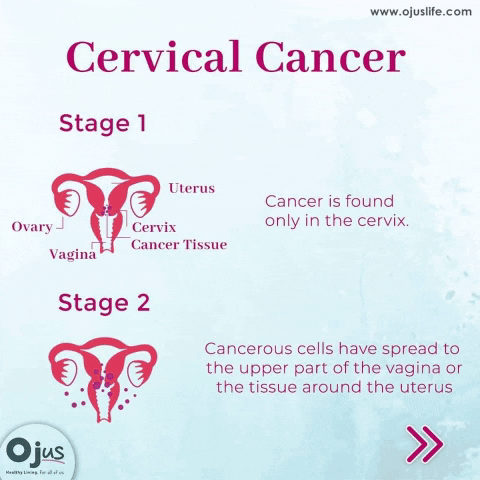 Cervical Cancer GIF