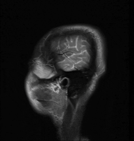 RedefineTheObvious skull head brain mind GIF