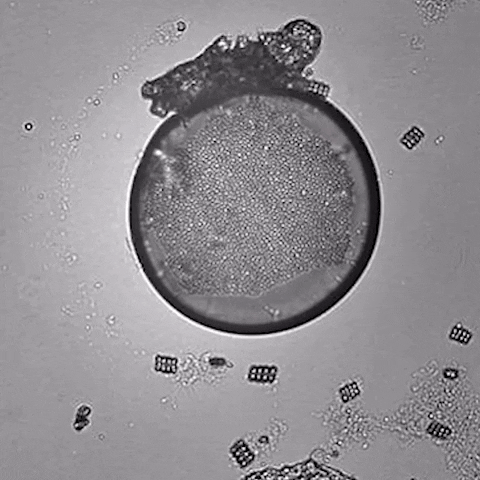 microscope microbes GIF by Harvard University