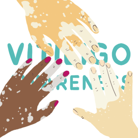 I've Got Spots! A book about vitiligo Sticker