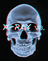 X-Ray GIF by AGAINST ALL ODDS