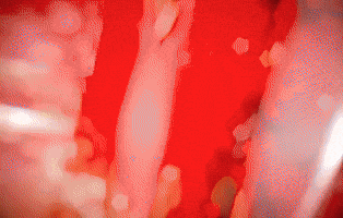 James Lee Donghua GIF