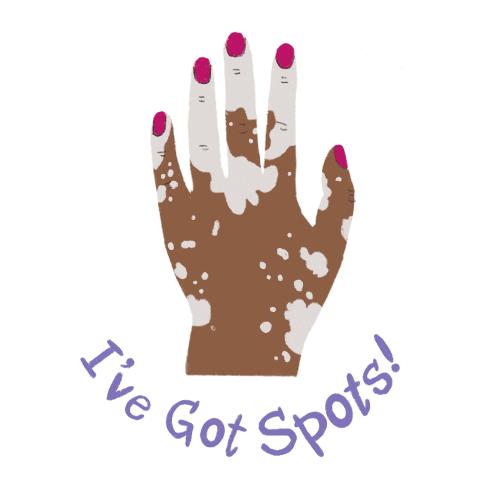 I've Got Spots! A book about vitiligo Sticker