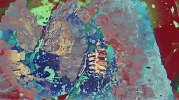 200.gif?cid=fc005b08e05e623f5b2cf5b5fa98baf55a30b53e97884e49&rid=200.gif&ct=g