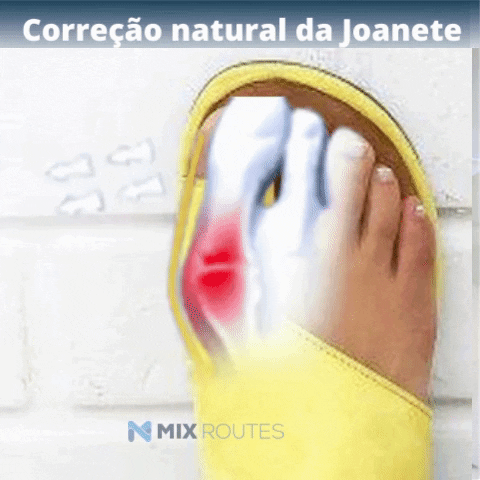 Sandália ortopédica para Joanete