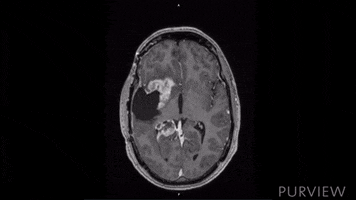 craig_purview pokemon GIF