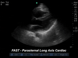 drjeffy foamed foamus GIF
