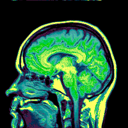 brain scan