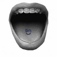 Bracesnow braces bracesnow bracesnowga GIF