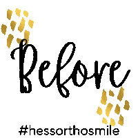 Logo Smile Sticker by Hessorthodontics