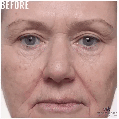 Before And After Anti Aging GIF by Westmore Beauty
