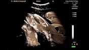 shark sonogram GIF