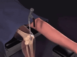 aldkfj9993 giphyupload GIF