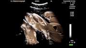 shark sonogram GIF